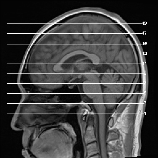 Click on the Serie image to view the images of VILLANUEVA, WILLIAM A.